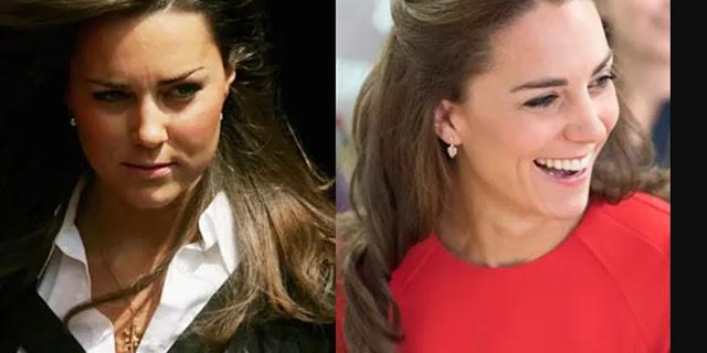 Surgeon speculates on cosmetic surgery procedures for 41-year-old Kate Middleton